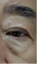 Before view for case 05