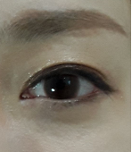 After view for case 06