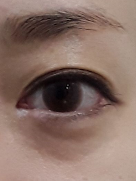 Before view for case 06