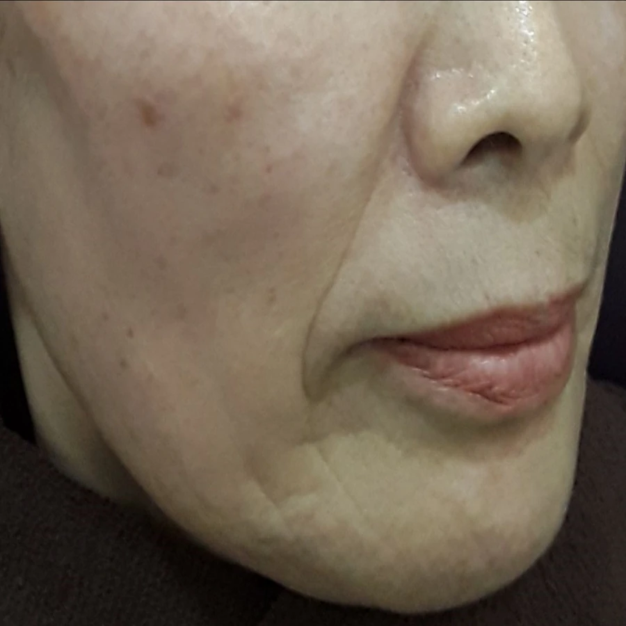 Before view for case 02